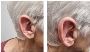 Expert Private Hearing Aids in Kenilworth 
