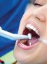 Full Mouth Rehabilitation in Perris | Nuevo Perris Dental