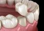  Pleasant Dental: Transformative Full Mouth Reconstruction S