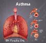 Asthma Specialist Doctor in Rajasthan