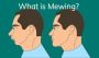 Know About Mewing: Experts Break Down What It Is and How to 