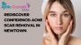Rediscover Confidence: Acne Scar Removal in Newtown