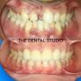 Best dental clinic near me | Best Invisalign treatment near 