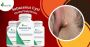 Useful Herbal Supplement for Sebaceous Cyst Natural Recovery