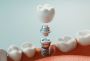 Improve Your Oral Health with Dental Implants