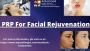 Experience the best PRP for facial rejuvenation in the US