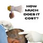 How Much Does Hair Transplant Cost in Chandigarh?