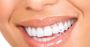 Shop Teeth Jewelry with Free Shipping on Ngen BJ