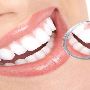 Achieve a Perfect Smile with Aligners for Teeth