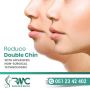 Double Chin Removal in Islamabad ,Exercise - RMC