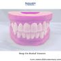 Snap On Veneers For Missing Teeth North Carolina