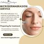 Non Invasive Microdermabrasion Treatment in Los Angeles