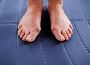 4 Treatments to Reduces Toe Bunion