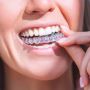 Experience The Best Teeth Whitening In Red Deer At Delta De