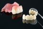 Dental Crowns Excellence: Transform Your Smile