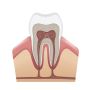 Comprehensive Root Canals Treatment Services in Jasper, AL