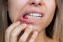 When Should You Seek Medical Attention for Bleeding Gums