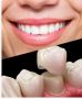 Transform Your Smile with Expert Cosmetic Dentistry in Perth