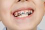 Get the Best Metal Braces for Kids in Greater Boston