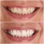 Enhance Your Smile, Enhance Your Beauty @ BODYWORX