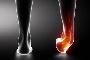 Sprained ankle treatment: 5 Remedies of sprained ankle