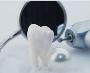 Wisdom Tooth Extraction: 4 Advantages 