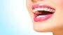 Braces Treatment: Does it hard to smile?