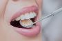 Is a teeth whitening procedure painful?