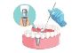 4 Benefits of extraction of wisdom tooth